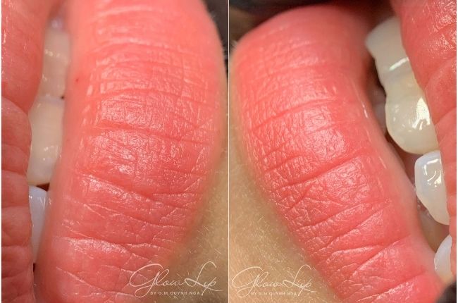 moi-sau-bong-khon-co-te