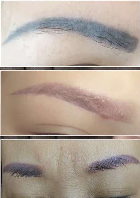 phun-xam-long-may-bi-tro-mau