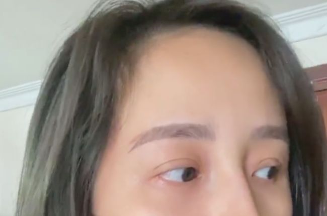 sua-long-may-bi-hong