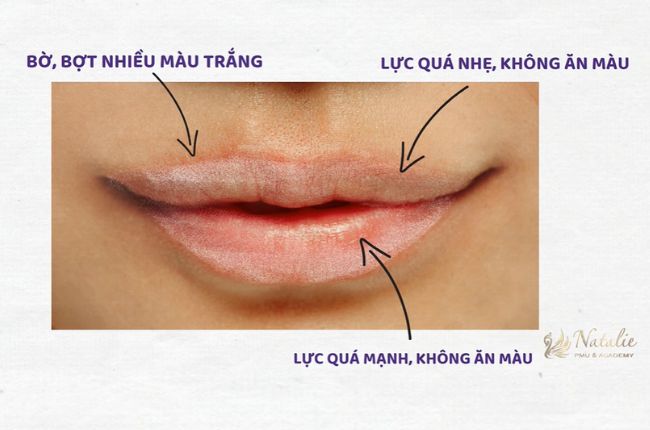 nguyen-nhan-moi-tham-loang-sau-phun