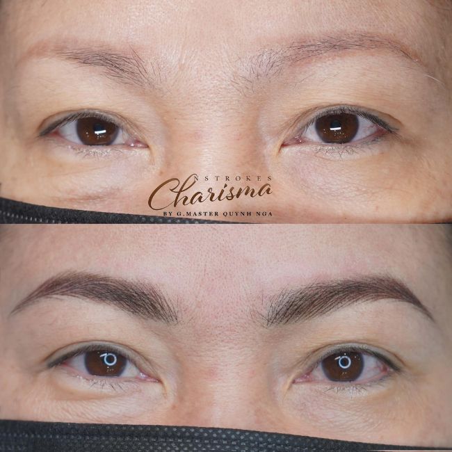 da-dau-nen-phun-hay-dieu-khac