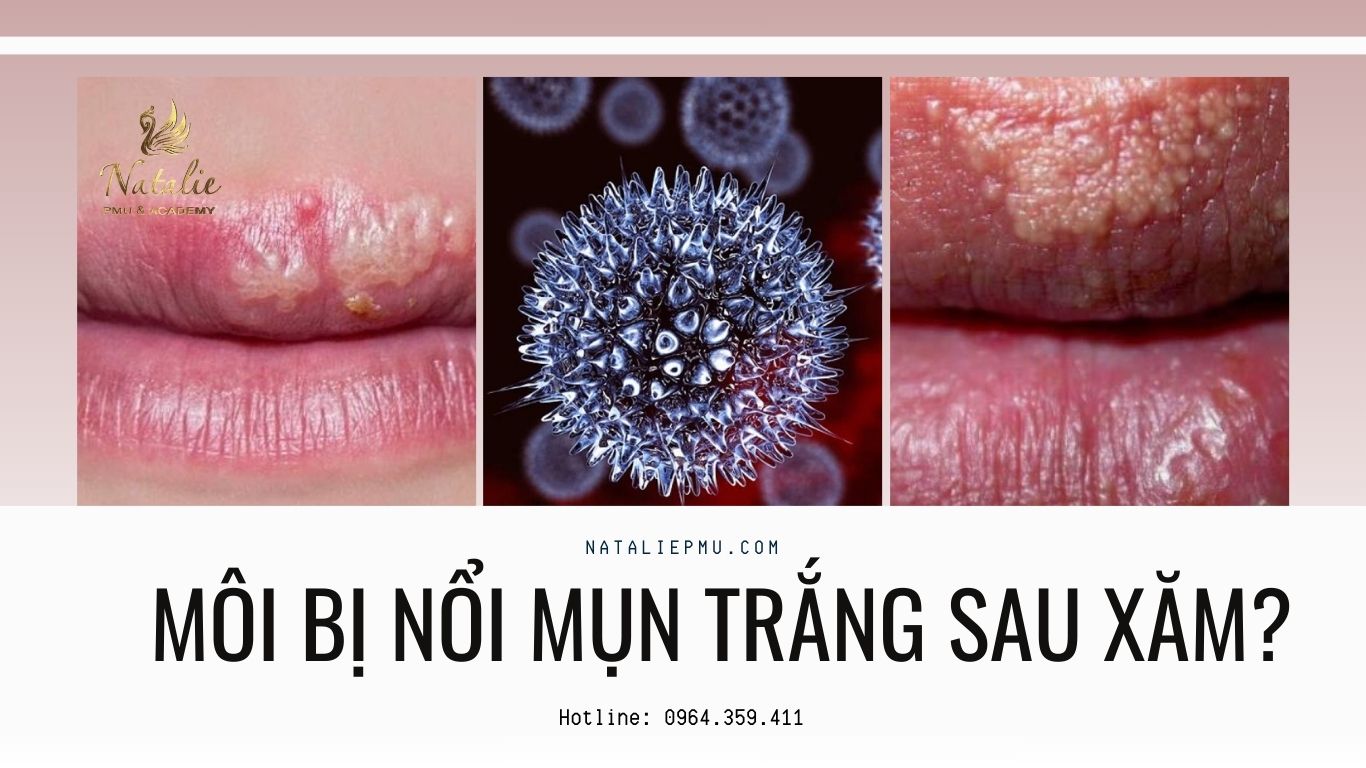 Môi Bị Nổi Mụn Trắng Sau Khi Xăm Do Đâu? Có Nguy Hiểm Không?