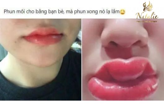 3-cach-lam-giam-sung-moi-tuc-thoi