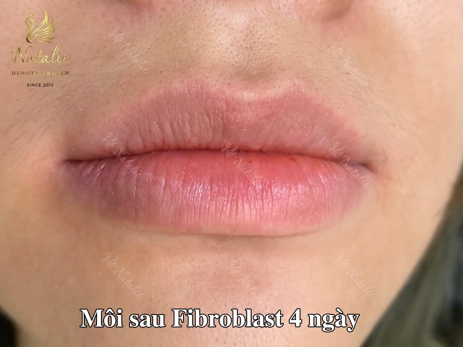moi-ni-noi-mun-trang-6