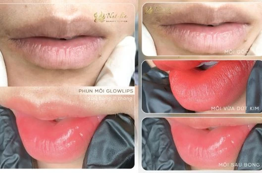 5-dia-chi-phun-moi-dep-tai-ha-noi-2